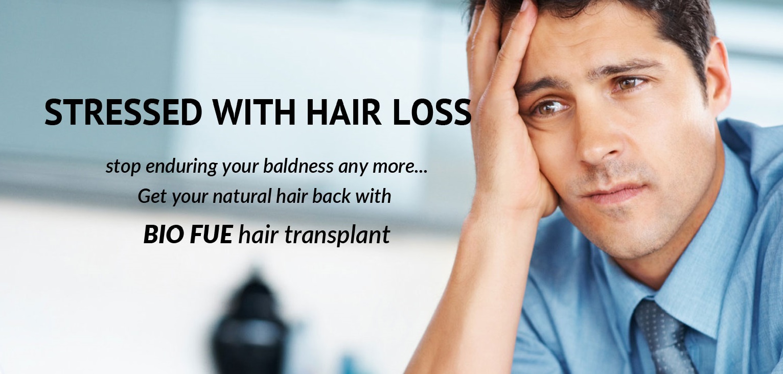 hair transplant | cost of hair transplant in delhi | hair transplant in  delhi